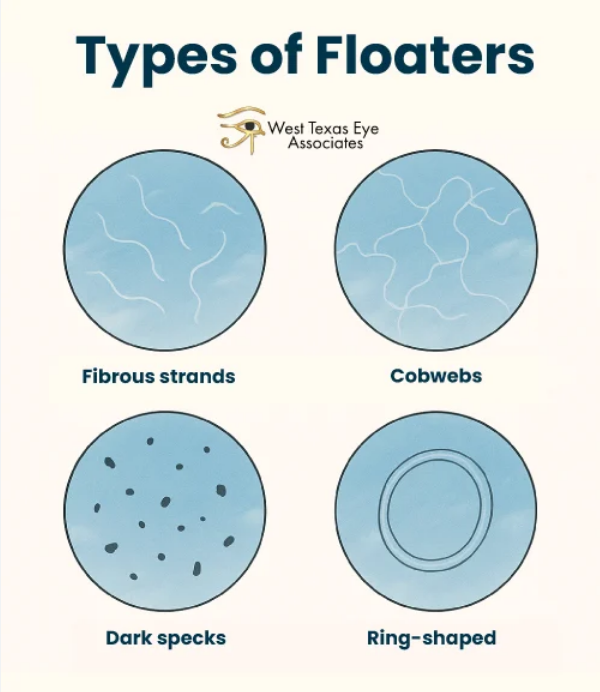 Eye Floaters