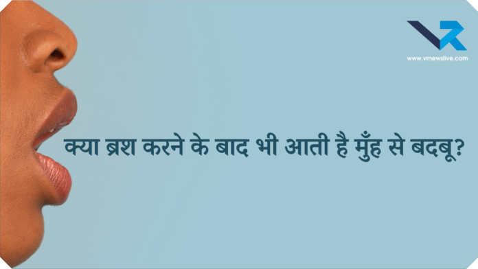 Halitosis Bad Breath