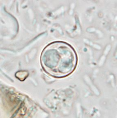 Cyclospora Cayetanensis