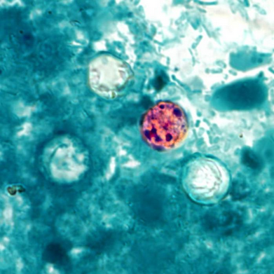 Cyclospora Cayetanensis