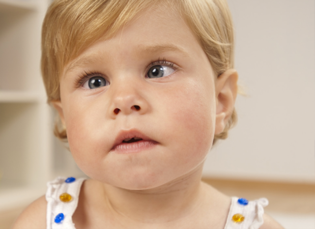 Lazy Eye or Squinting