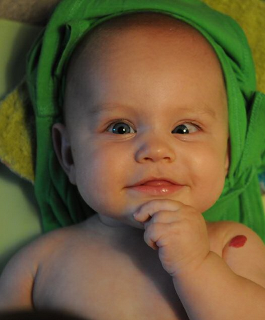 Lazy Eye or Squinting