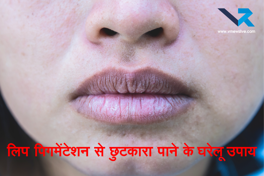 Lip Pigmentation