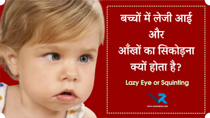 Lazy Eye or Squinting