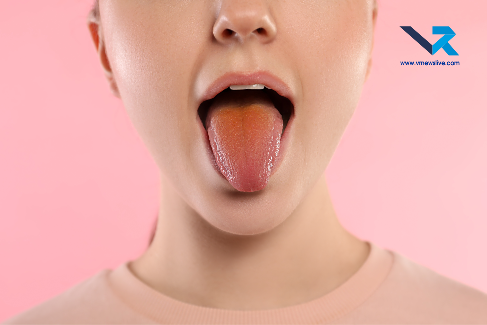 Tongue Color and Health