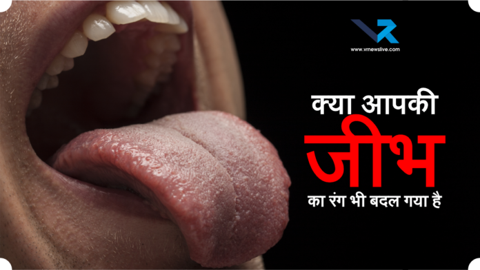 Tongue Color and Health