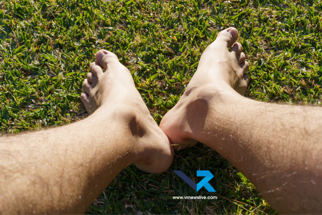 Heat Edema