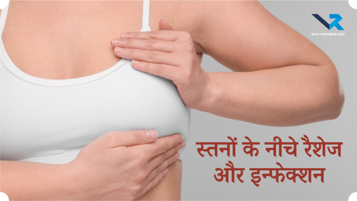Under Breast Rashes