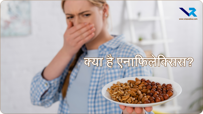 Nuts Allergy