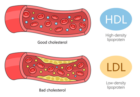Cholesterol