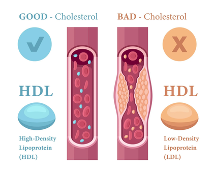 Cholesterol